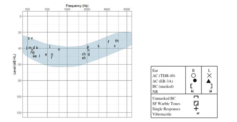 Audiogram with shaded area to show average pitch and loudness