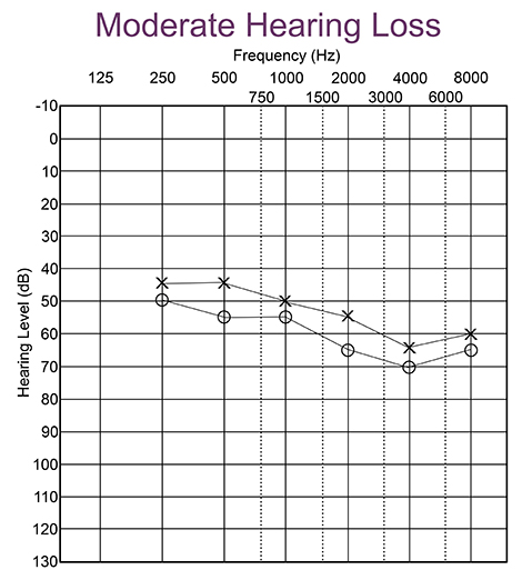 What Is An Audiogram Understanding Hearing Test Results What Is An Audiogram Understanding Hearing Test Results