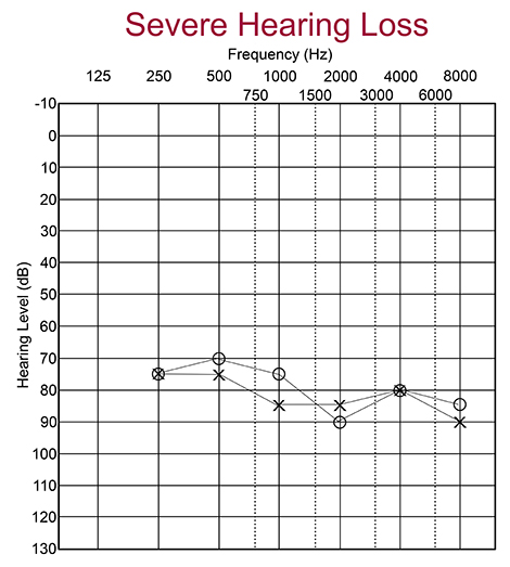 Hearing Test Chart