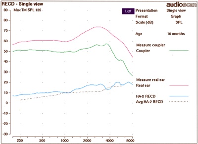 Figure 1. Measured RECD on a 10 month-old.