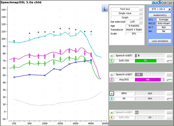 Figure 2 - Verifying output of the hearing aid in response to soft (green output) and average (pink output) speech and MPO (light blue output).